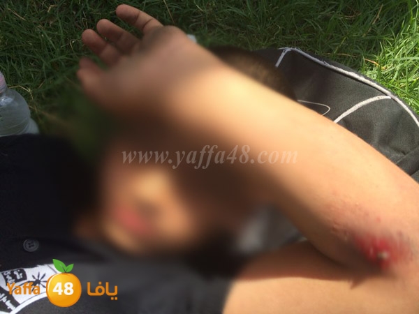 accedent lud kid hit 0522 (12).JPG